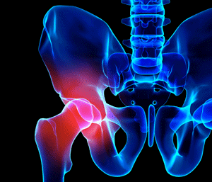 skeletal image of hip joint