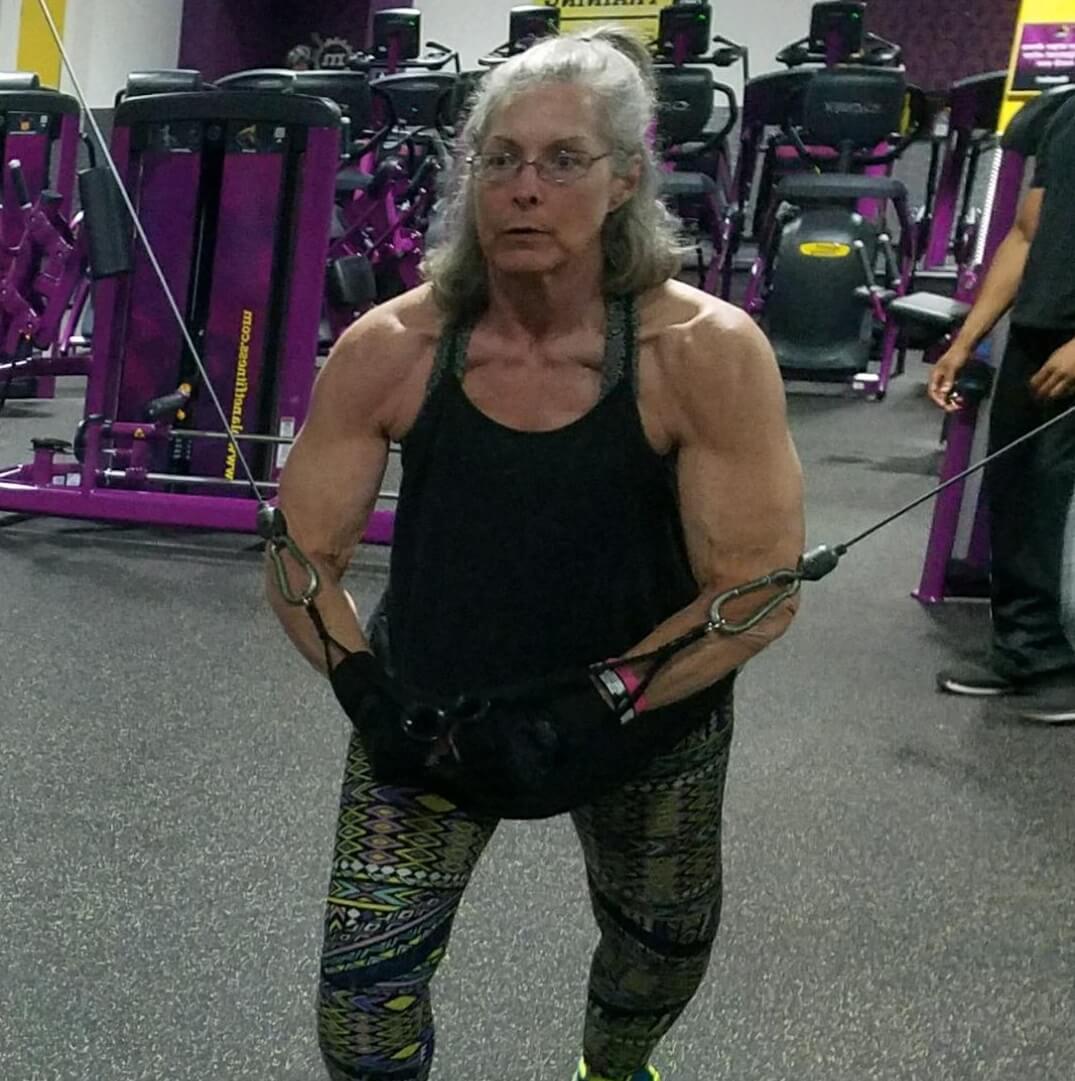 With the CentraCare Weight Management Program, Robin lost more than 35 pounds in six months. Along with surgery for an adjustable lap band, her weight now hovers in the mid-170. Robin is now an active bodybuilder and works as a personal trainer.